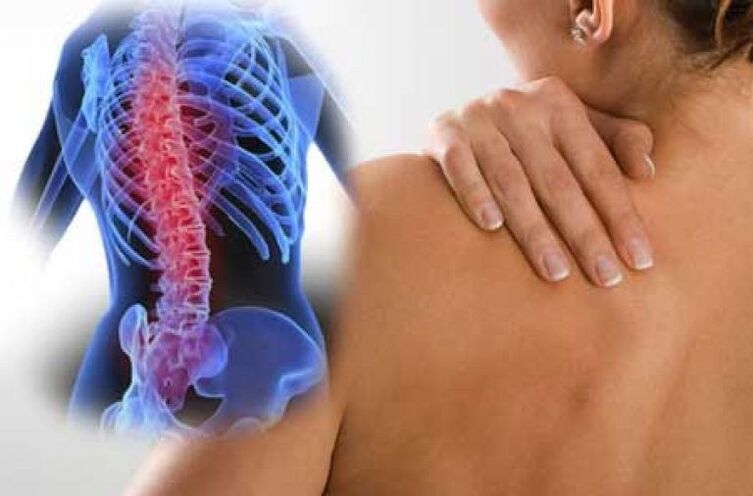 Sa osteochondrosis, ang sakit ay maaaring magningning sa malalayong bahagi ng katawan