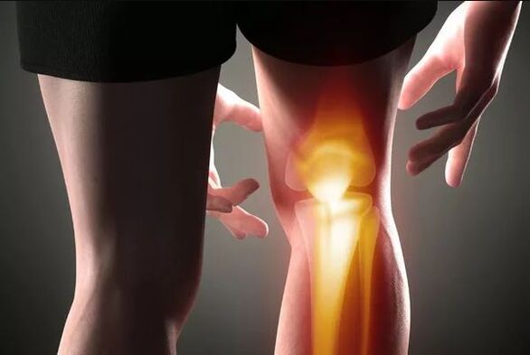 Arthrosis ng kasukasuan ng tuhod