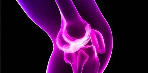 Arthrosis sa kasukasuan ng tuhod