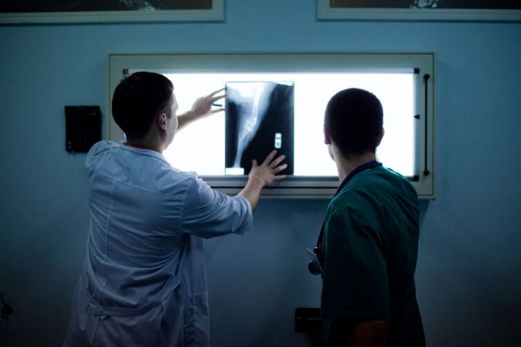 Diagnosis ng arthrosis sa x -ray