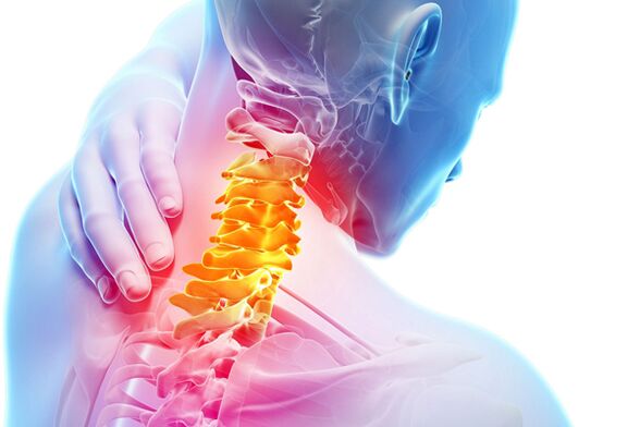 Cervical osteochondrosis