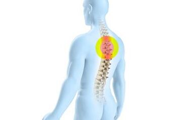osteochondrosis ng thoracic spine