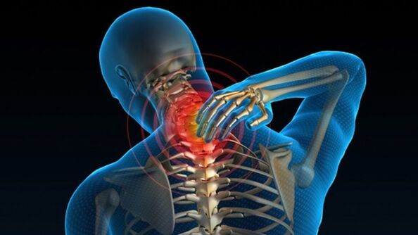 Ang sakit kapag pinihit ang leeg ay maaaring magpahiwatig ng vertebral cervical osteochondrosis syndrome