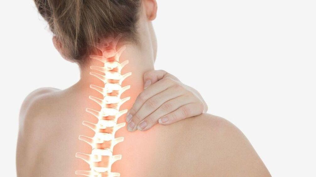 Sa osteochondrosis ng cervical spine, maaaring umunlad ang radicular syndrome